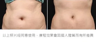 減脂三重奏瘦腰腹