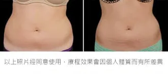 減脂三重奏瘦小腹