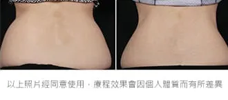 減脂三重奏瘦馬鞍