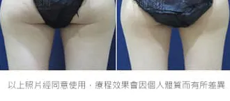 減脂三重奏瘦屁股